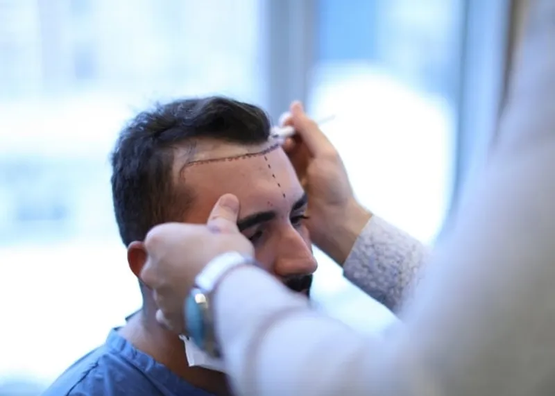 Treatment room used for hair transplant procedures at the Istanbul clinic.