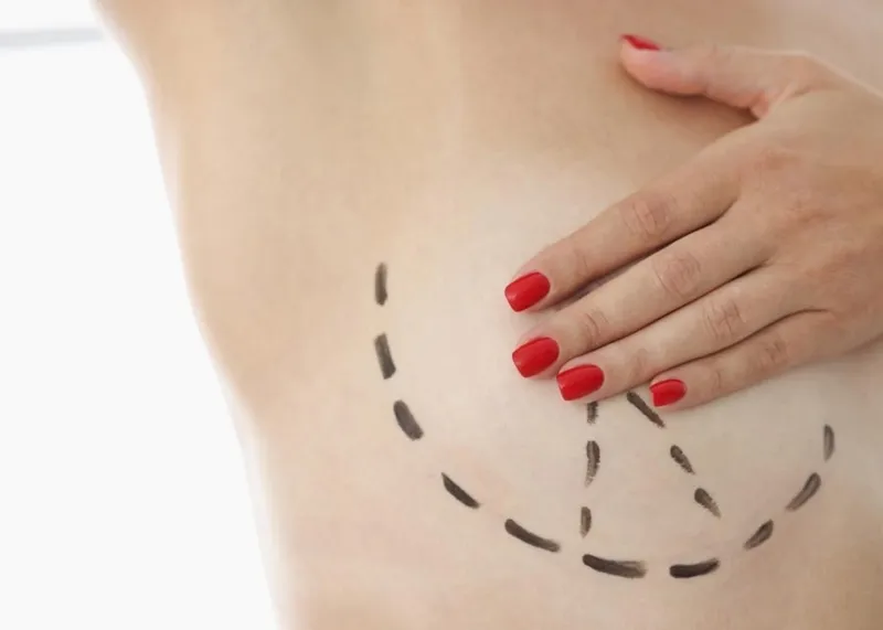 A patient discusses breast surgery options and pricing with a plastic surgeon in an Istanbul clinic consultation room.