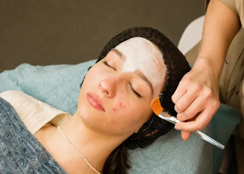 Chemical peel solution being applied to a patient's cheek with a soft brush