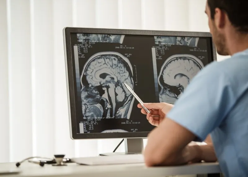 Gamma Knife Radiosurgery in Istanbul