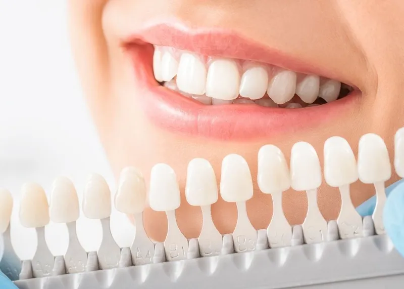 Patient undergoing a dental procedure in a treatment chair at a clinic in Istanbul.