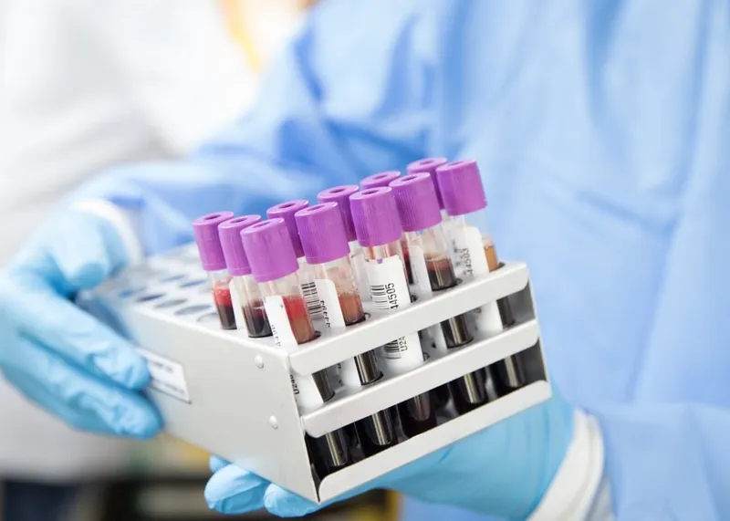 Pathologist examining biopsy slides under a microscope for a second opinion