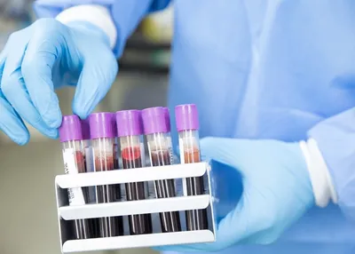 Lab Services in Istanbul: Tests, Results, and Reports