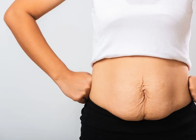 Frau ruht sich während der Erholungsphase nach einer Mommy-Makeover-Operation entspannt aus.