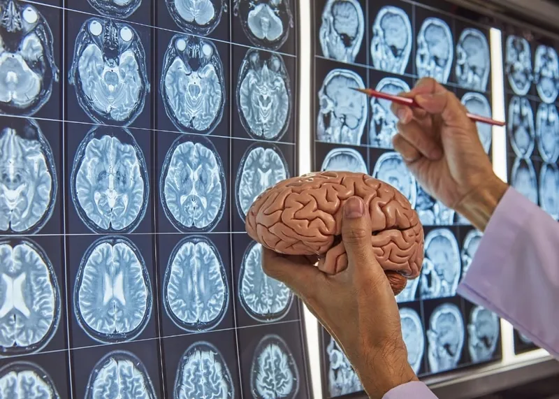 Advanced neurological diagnostic imaging in use at an Istanbul medical center