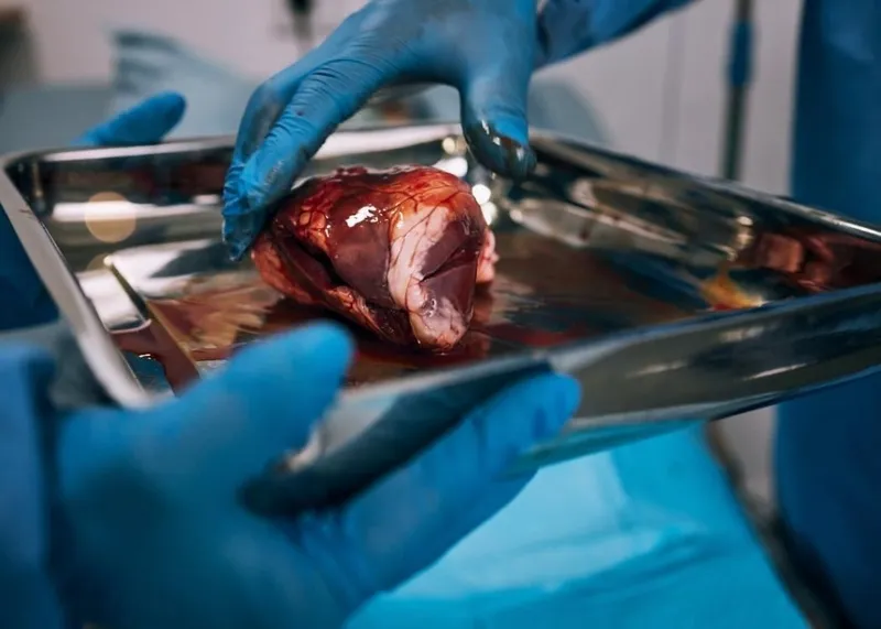 Transplant surgeons performing an organ transplantation operation in a modern hospital in Istanbul, Turkey.