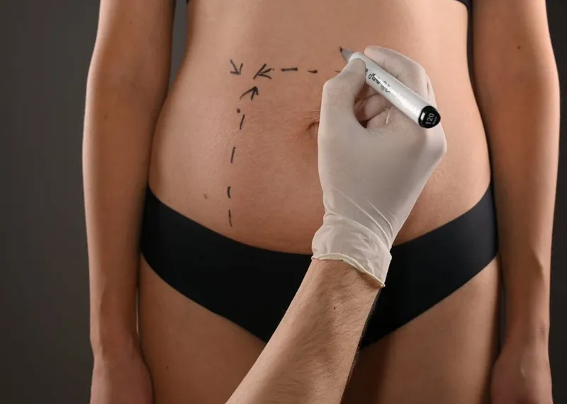 Patient reviewing a combined surgery plan with her plastic surgeon