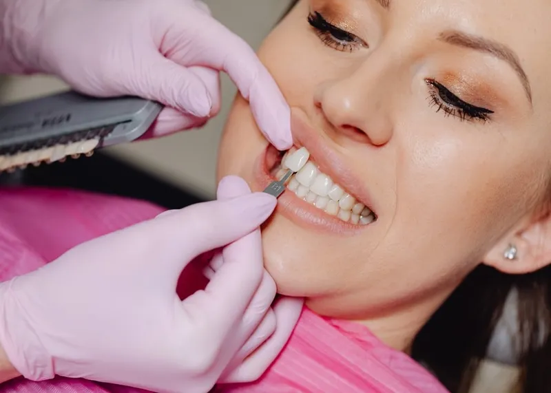 A dentist checks veneer shade and fit during a smile makeover appointment in Istanbul.