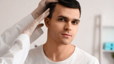 hair transplant hospitals