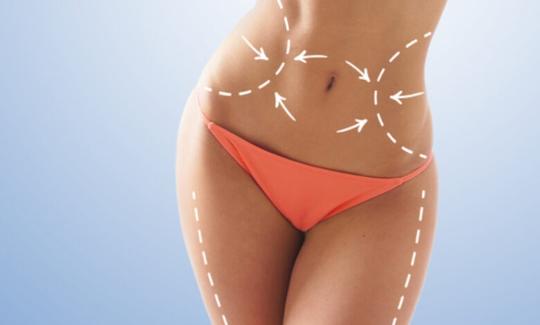 body aesthetics