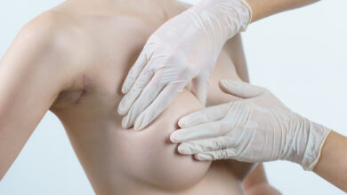 Breast Aesthetics in Istanbul silicon implant breast