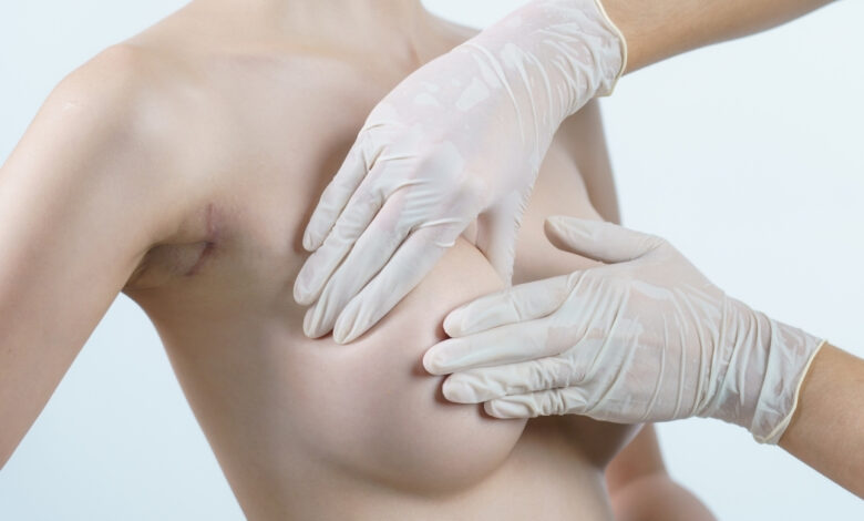 Breast Aesthetics in Istanbul silicon implant breast