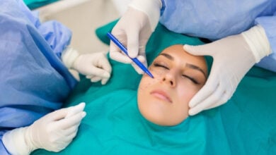 head face eyes plastic surgery