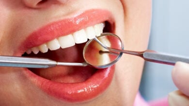dental care istanbul turkey dentict top clinics prices