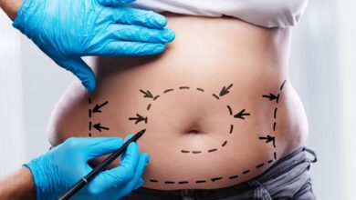 mommy makeover surgery istanbul