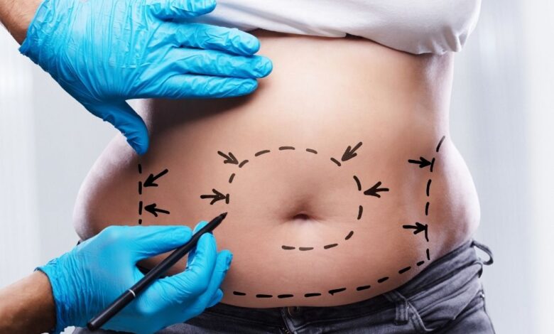 mommy makeover surgery istanbul