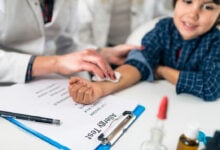 Allergy and Immunology istanbul turkey medical treatments