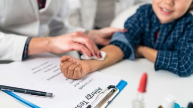 Allergy and Immunology istanbul turkey medical treatments