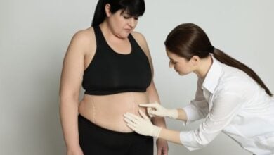 weight loss surgery istanbul