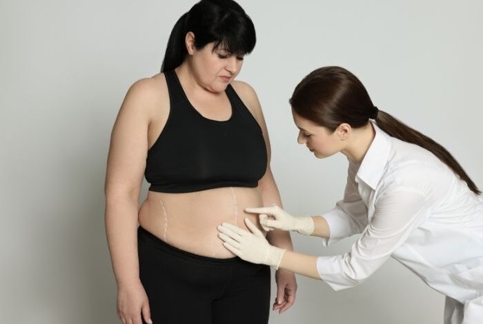 weight loss surgery istanbul