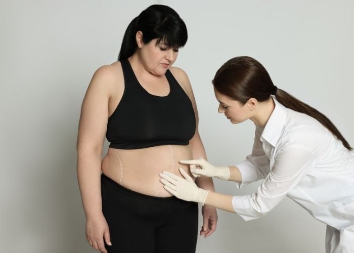 weight loss surgery istanbul