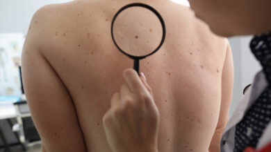 dermatology skin care istanbul laser botox filling cancer treatments