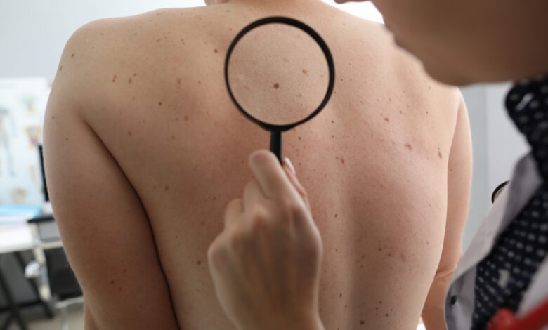 dermatology skin care istanbul laser botox filling cancer treatments