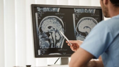 gamma knife surgery istanbul (3)