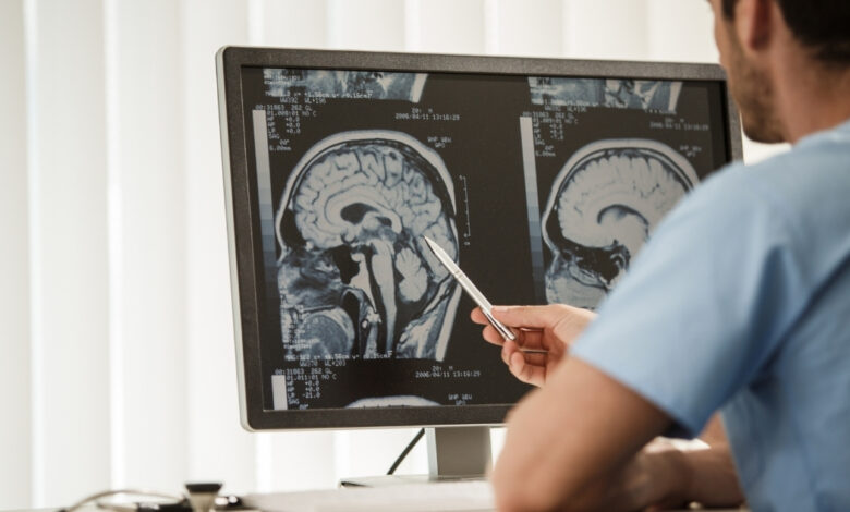 gamma knife surgery istanbul (3)