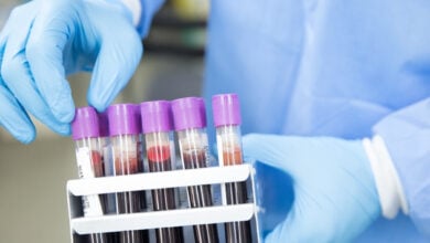 lab services in istanbul labs results cancer blood tests (6)