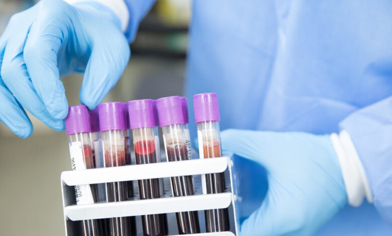 lab services in istanbul labs results cancer blood tests (6)