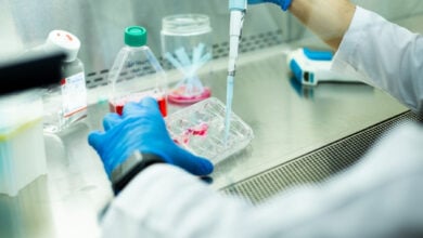 stem cell therapy cancer treatment istanbul doctor patient