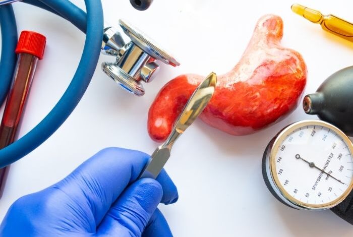 weight loss surgery
